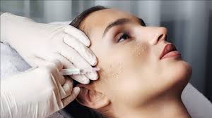 Як підготуватися до ін’єкцій краси: ботокс, філери, біоревіталізація — покрокова інструкція